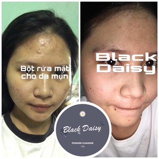 Bột rửa mặt Black Daisy