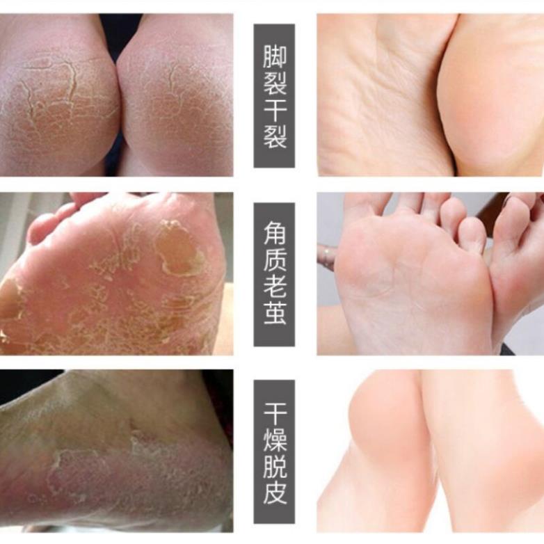 [FREESHIP] Kem Bôi Nứt Nẻ Ngoài Da Hiệu ÔNG GIÀ 30g | BigBuy360 - bigbuy360.vn