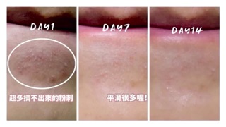 SẢN PHẨM DR WU MANDELIC ACID