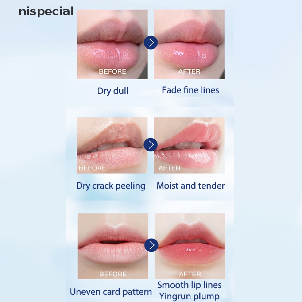 (Hàng Mới Về) Son Dưỡng Môi Vaseline Dưỡng Ẩm Chống Nứt Môi Lâu Trôi