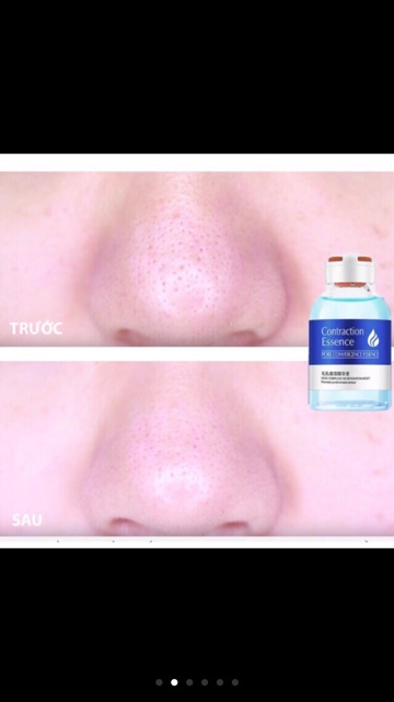 Serum xanh se lỗ chân lông cấp nước cho da siêu hiệu quả