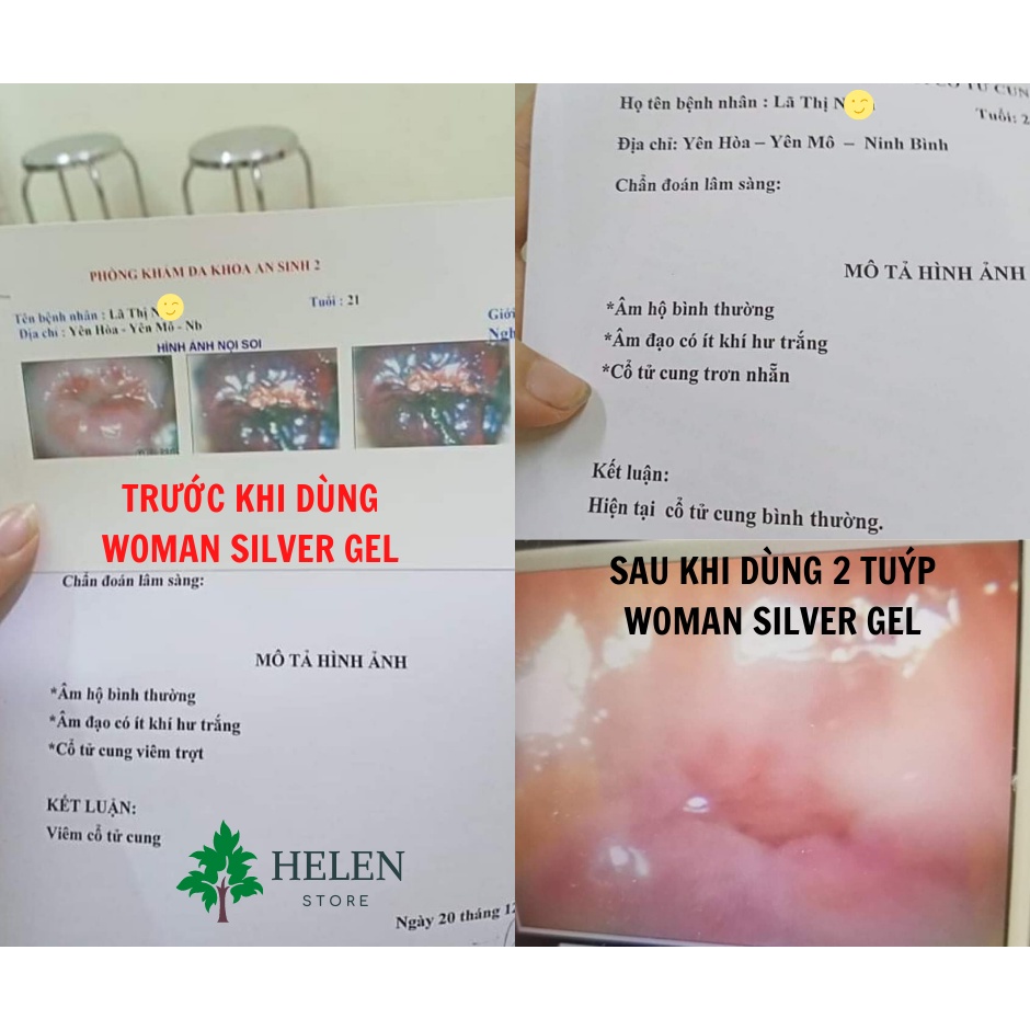 [MUA 2 TẶNG 1] Gel phụ khoa 💖WOMAN SILVER GEL💖Dung dịch vệ sinh phụ nữ Nano bạc TÁO XANH VIỆT NAM 💖 Che tên sản phẩm