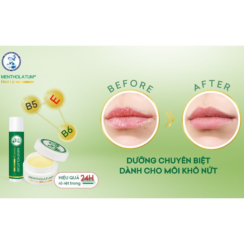 Son dưỡng môi chuyên biệt dành cho môi khô, nứt nẻ Mentholatum Medi Lip Stick (4.3g)