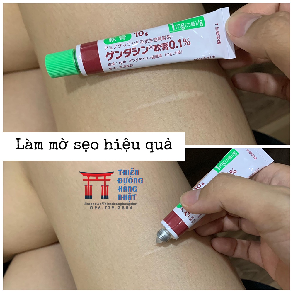 Kem sẹo bôi Gentacin Nhật Bản 10g