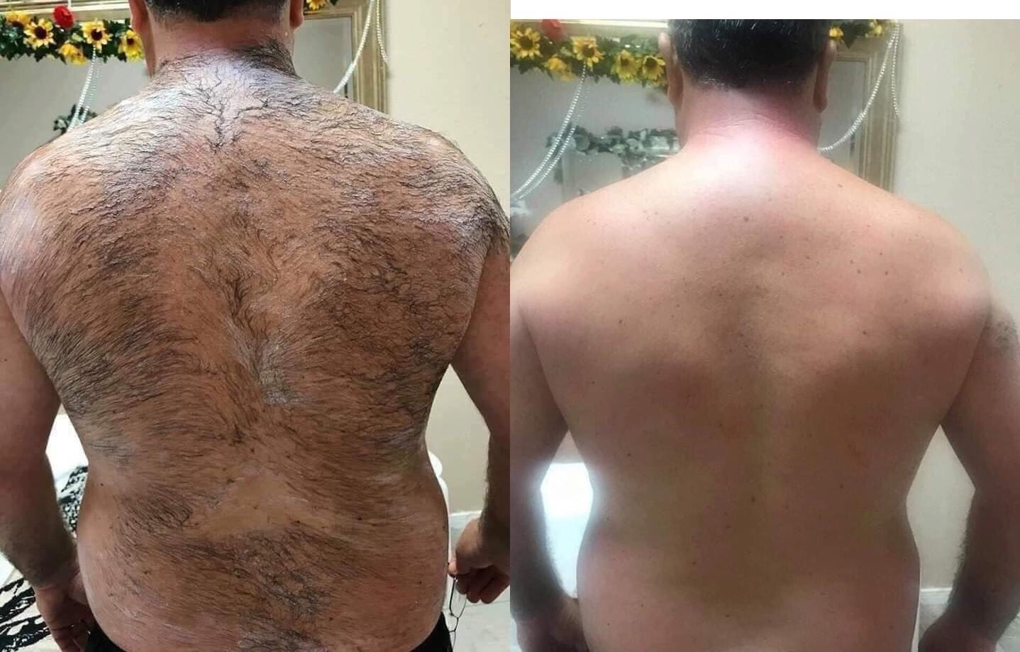 Kem Tẩy Lông Huyền Phi [ Mua 1 Tặng 1 Serum] triệt lông tận gốc, lông nách, lông bikini, ria mép, râu,triệt mùi hôi nách | BigBuy360 - bigbuy360.vn