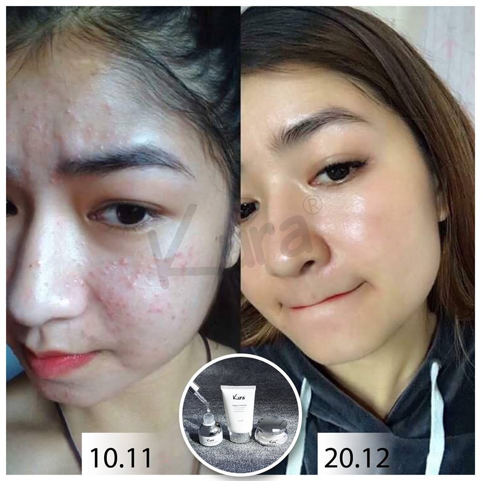 Sữa Rửa Mặt Cao Cấp - Kura Perfect Cleanser 50 ML | BigBuy360 - bigbuy360.vn