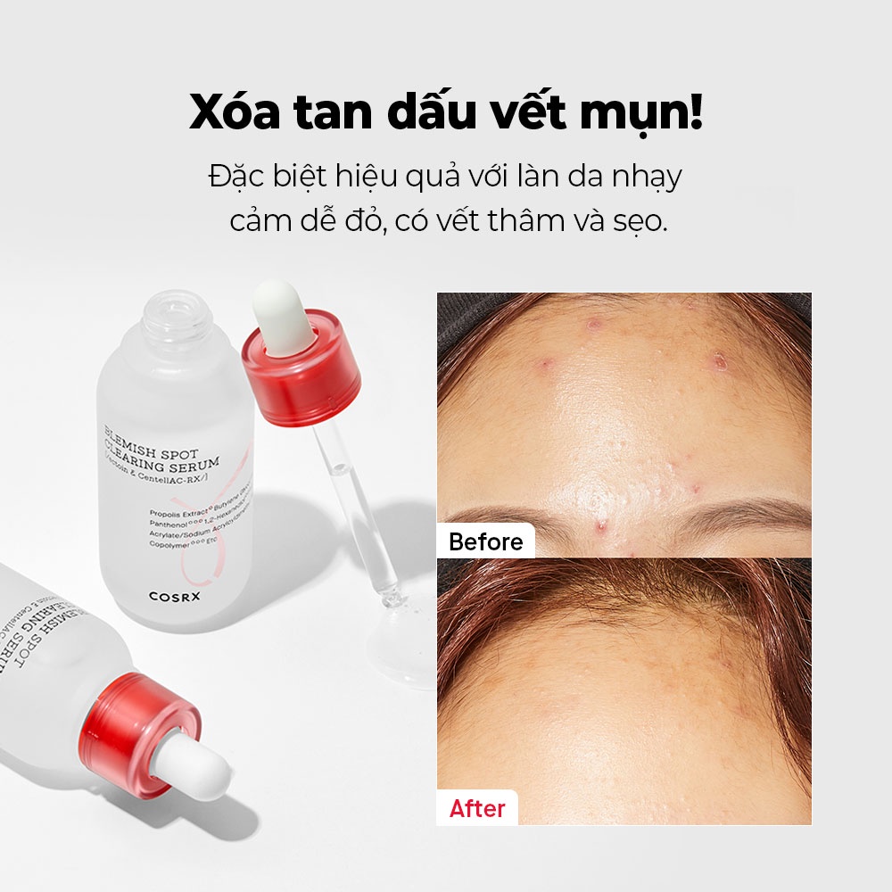 Tinh chất serum dưỡng làm mờ vết thâm COSRX AC Collection Blemish Spot Clearing Serum 40ml