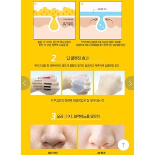MẶT NẠ SỦI BỌT CHUỐI MISSDAY CARBONATED BUBBLE PACK