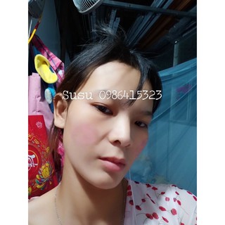 MỸ PHẨM PEEL TCA CHẤM NÁM, RO, TÀN NHANG, ĐỒI MOI..