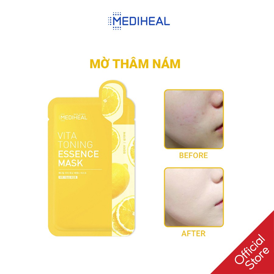 Mặt Nạ Làm Trắng Da, Mờ Thâm Nám Mediheal Vita Toning Essence Mask 20ml [K111]