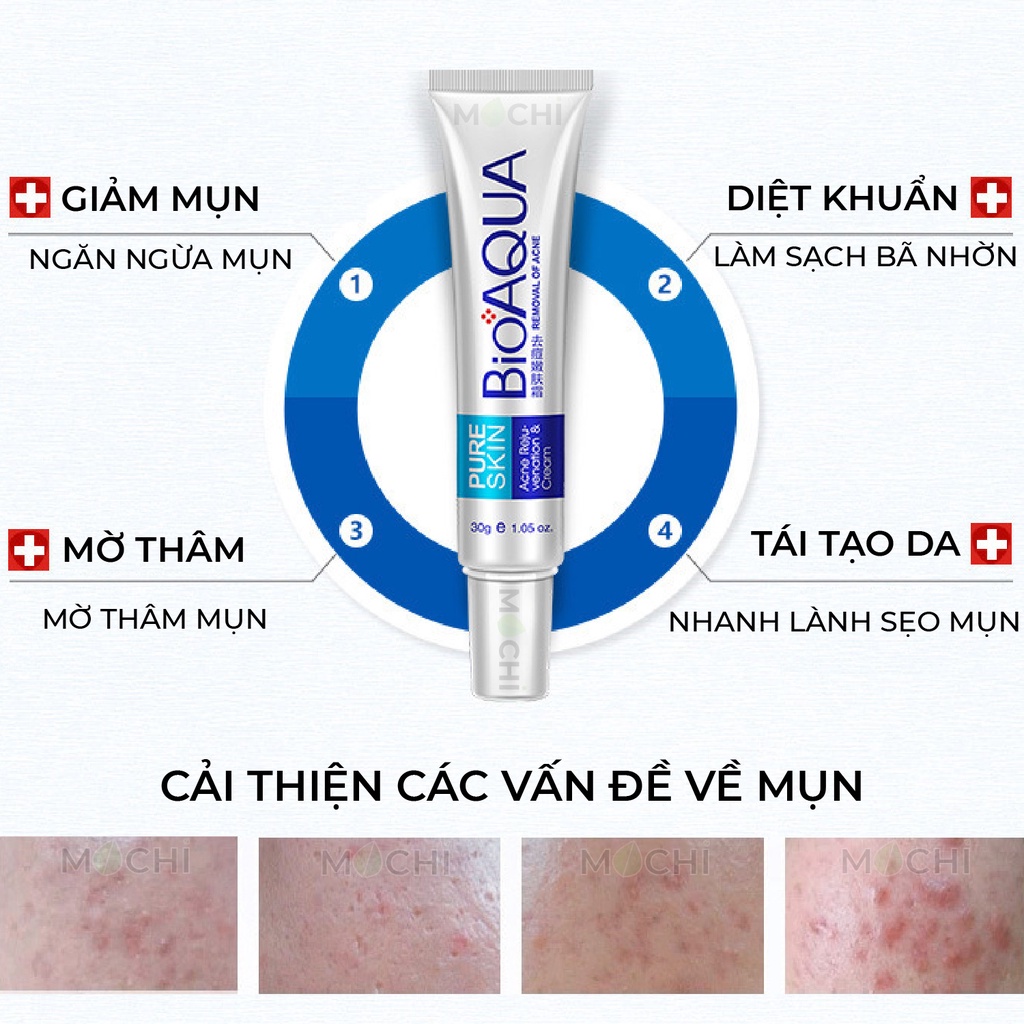 Kem Mụn Acne Bioaqua Giảm Mụn Trứng Cá l Mụn Bọc l Mụn Đầu Đen l Mụn Cám Dưỡng Da Mụn Nội Địa Trung MOCHI SHOP