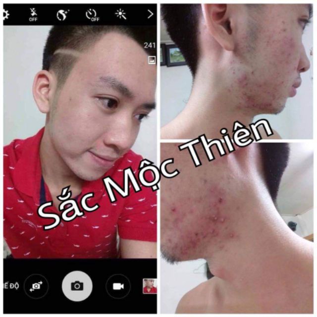 TINH CHẤT TÁI TẠO DA SẮC MỘC THIÊN