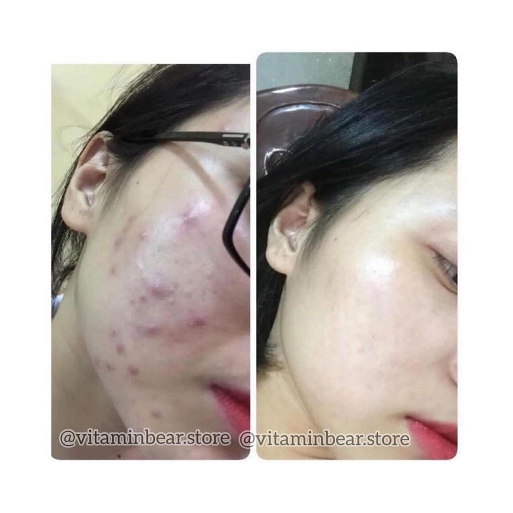 Dầu Tamanu Giúp Dưỡng Da, Mềm Mịn - 100% Thành Phần Từ Thiên Nhiên