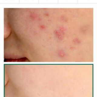 ️Some By Mi AHA-BHA-PHA 30 Days Miracle Serum