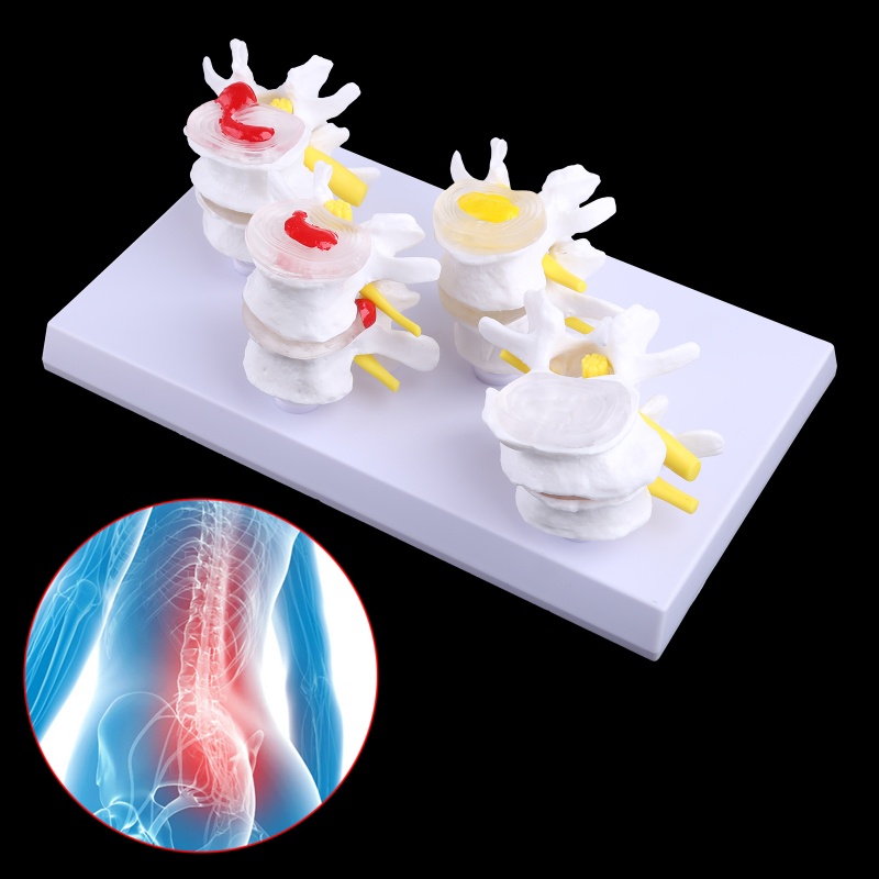 1 Bộ Mô Hình Tượng Người Giảng Dạy Y Tế