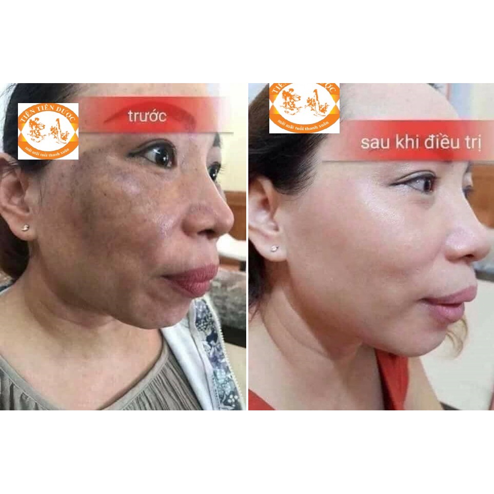 Combo tái tạo da Tiên Tiên Dược