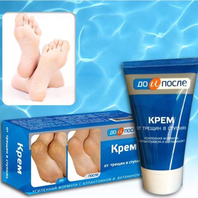 Kem Dưỡng Gót Chân Kpem Ngăn Ngừa Và Hồi Phục Nứt Nẻ - Chính Hãng Nga 50ml