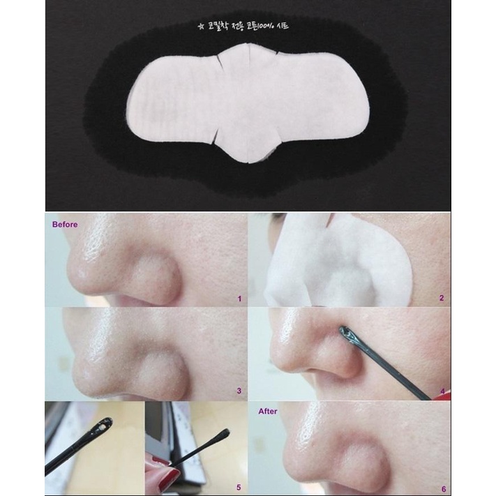 Miếng Đẩy Mụn Đầu Đen Ciracle Good-bye Blackhead