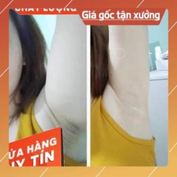 [GIÁ TỐT] BIHOLADI 5S Dưỡng Thâm Ngăn Ngừa Thâm Sạm vùng NÁCH, BẸN, MÔNG, BỤNG, CÙI CHỎ, ĐẦU GỐI, MẮT CÁ CHÂN