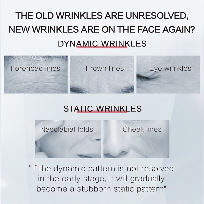 Tinh chất Retinol Vitamin A PROYA chống nếp nhăn lão hóa chăm sóc da 30ml