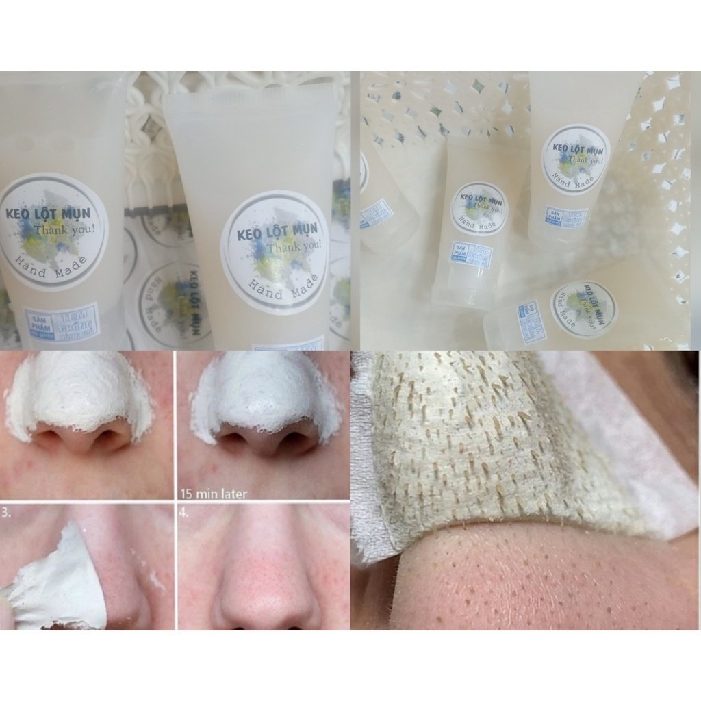 Gel lột mụn hàng Hanmade