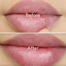 Tẩy tế bào chết môi Beauty Treats Lip Scrub 10,5 gram | BigBuy360 - bigbuy360.vn