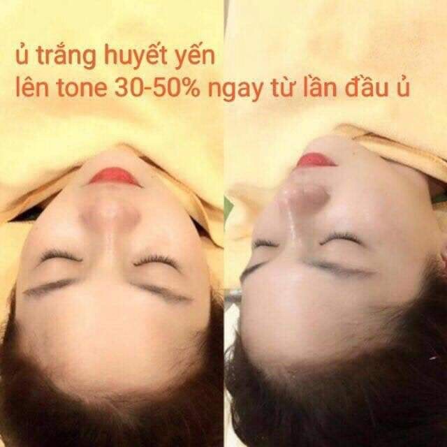 Ủ Trắng Mặt Olee White Huyết Yến Collagen | BigBuy360 - bigbuy360.vn