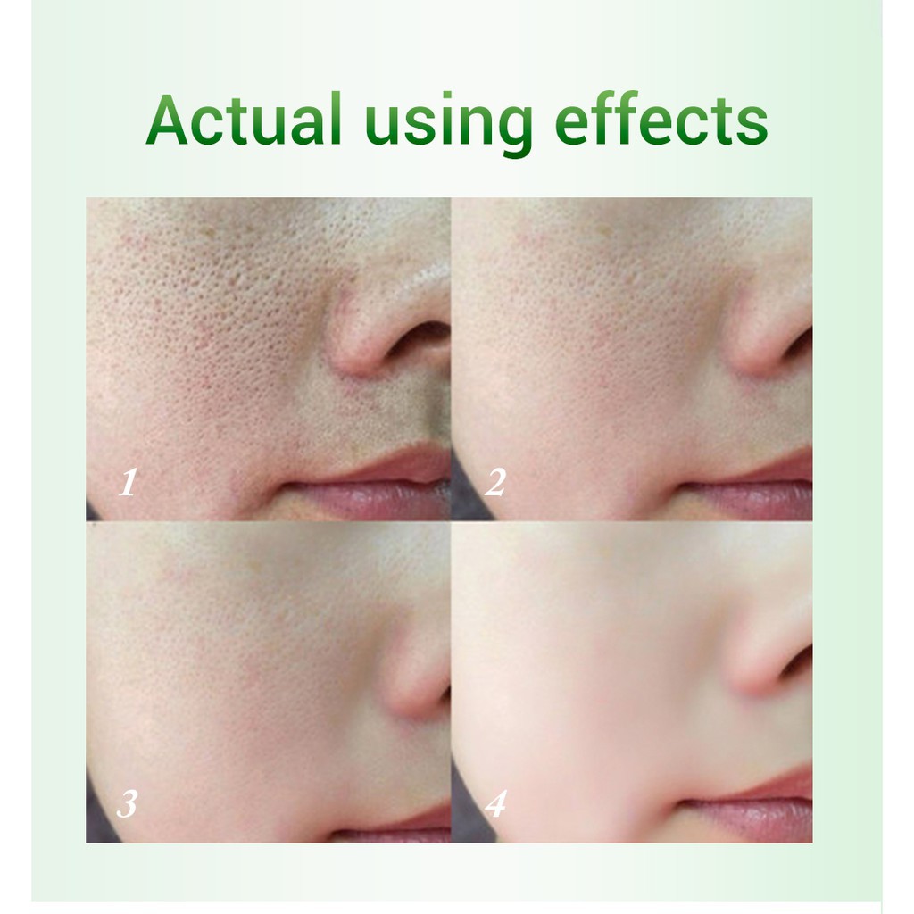 BREYLEE Pore Tightening Essence Shrinking Moisturizing Oil Control Anti-aging Skin Care 17 ml