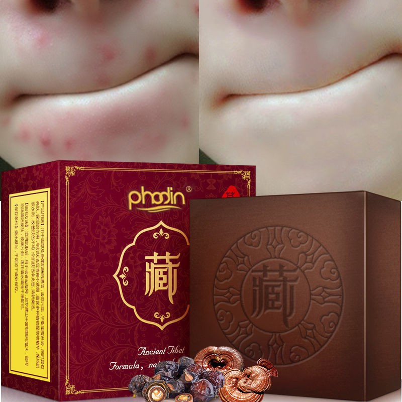 (hàng Mới Về) Xà Phòng Tạo Bọt Tây Tạng hỗ trợ giảm Mụn Đầu Đen Làm Trắng Da