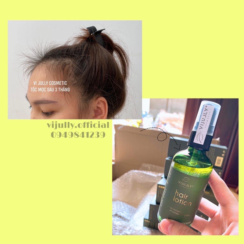 [TẶNG 2 QUÀ XINH🌸] Tinh dầu bưởi Vijully, Xịt bưởi Vijully Giảm rụng , kích mọc tóc | BigBuy360 - bigbuy360.vn