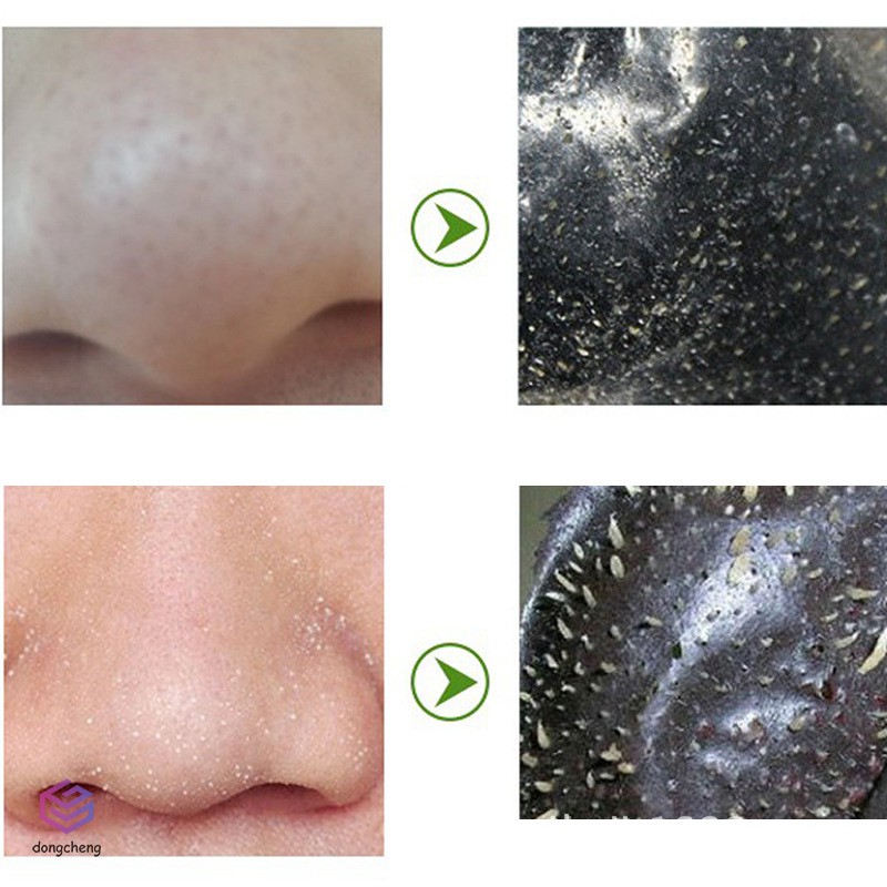 [Hàng mới về] 10 Miếng dán mũi lột mụn đầu đen làm sạch sâu lỗ chân lông hiệu quả