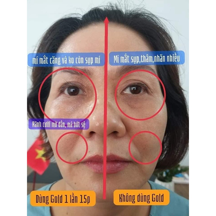 [DATE 05/22] Tinh chất vàng 24k Protein Peptide và chỉ căng cơ Protein Nano SARADOR GOLD PROTEIN PEPTIDE (Nhât)