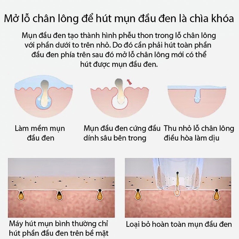 Máy hút mụn bã nhờn mini cao cấp cầm tay