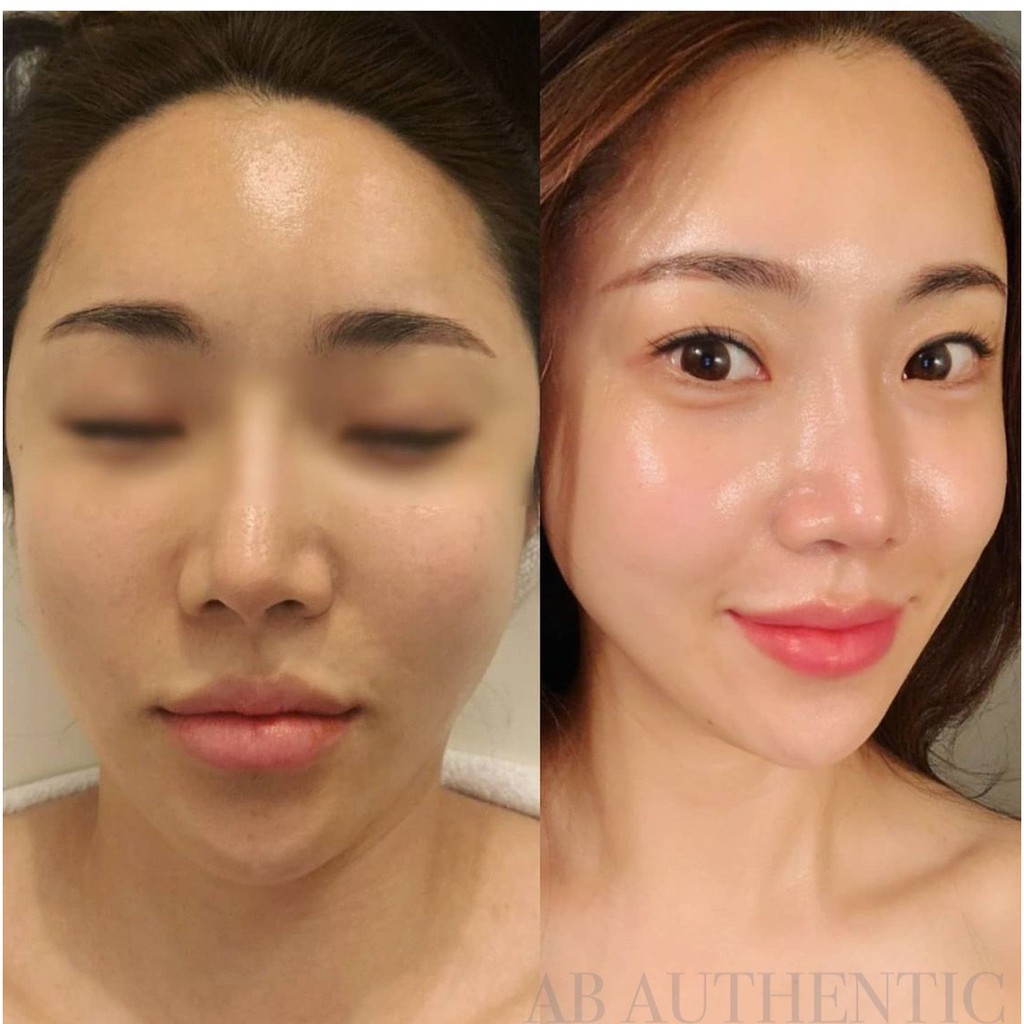 Gói sample Kem dưỡng cấp nước, phục hồi da Blue Microlift Hydra CNP(Rx) cream