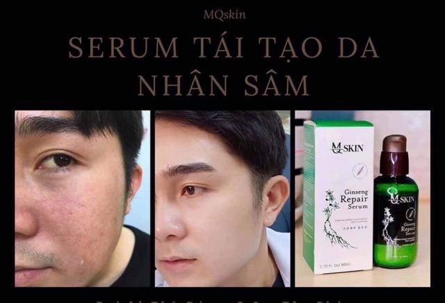 Serum tái tạo da nhân sâm MQskin ♥️Chính hãng♥️ Trị dứt điểm các vấn đề về da | BigBuy360 - bigbuy360.vn