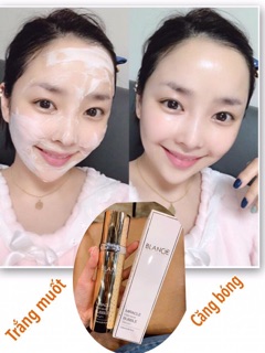 SERUM BALANCE WHITE ANGLE trắng da căng bóng.