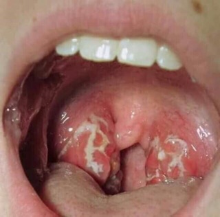 Tinh đâu răng miệng đâu thảo liên