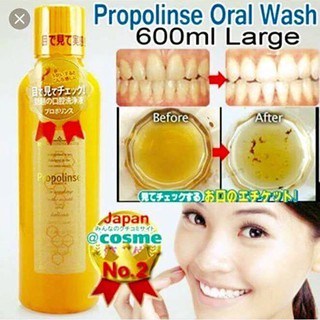 Nước súc miệng Propolinse
