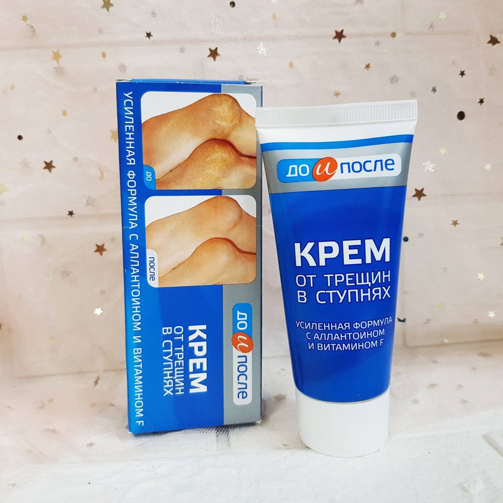 Kem Trị Nứt Gót Chân Nga Kpem 50ml