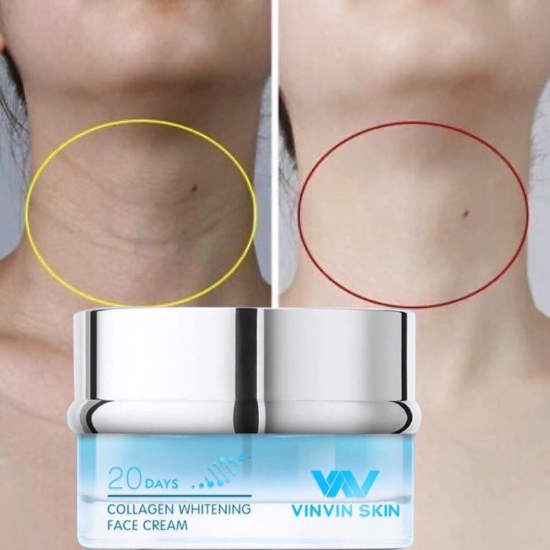 (Chính hãng )Kem Face dưỡng trắng phục hồi da hư tổn- COLLAGEN WHITENING FACE CREAM | BigBuy360 - bigbuy360.vn