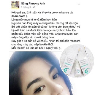 THUỐC KÍCH MỌC DÀI MI CAREPROST
