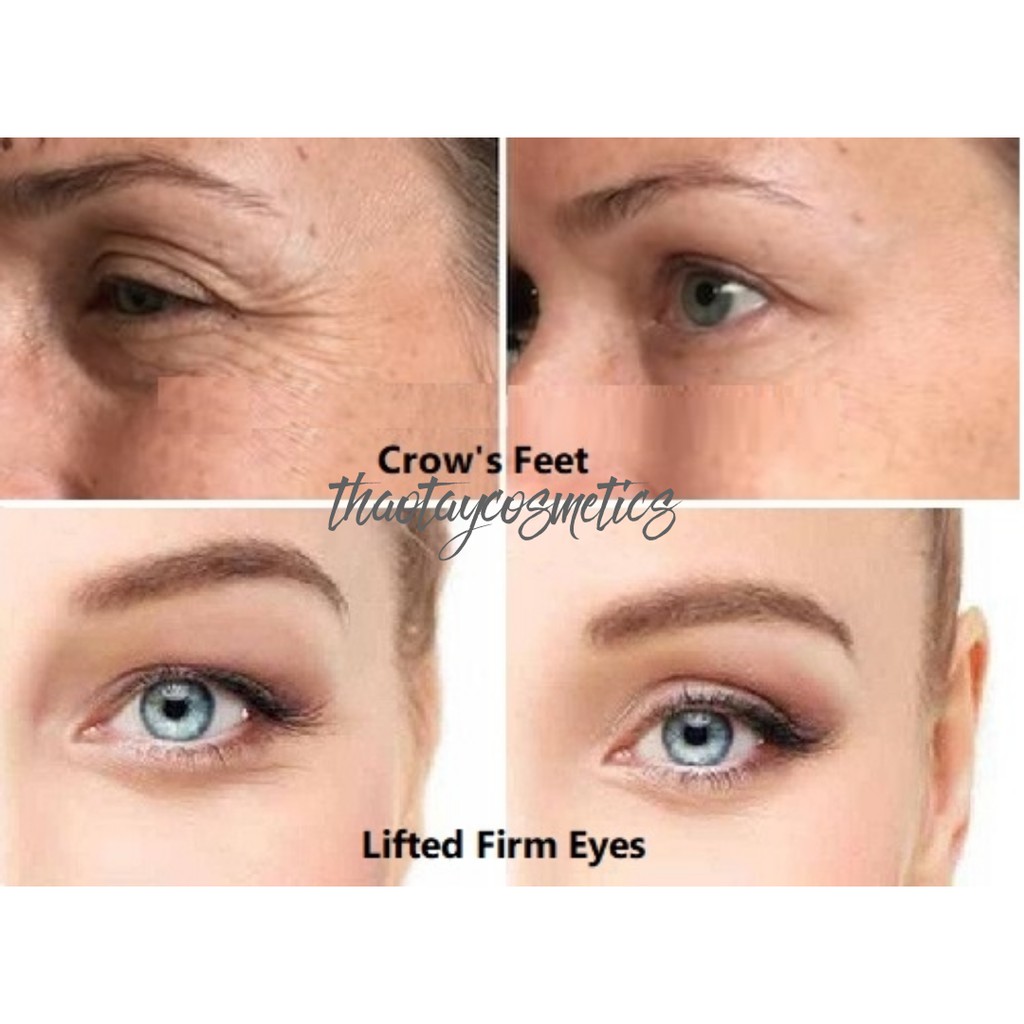 [Hàng Mỹ] Kem dưỡng mắt Olay Eyes (Crow's Feet/ Visibly Lifted Firm Eyes/ Deep Wrinkles/ Sagging Skin) | BigBuy360 - bigbuy360.vn