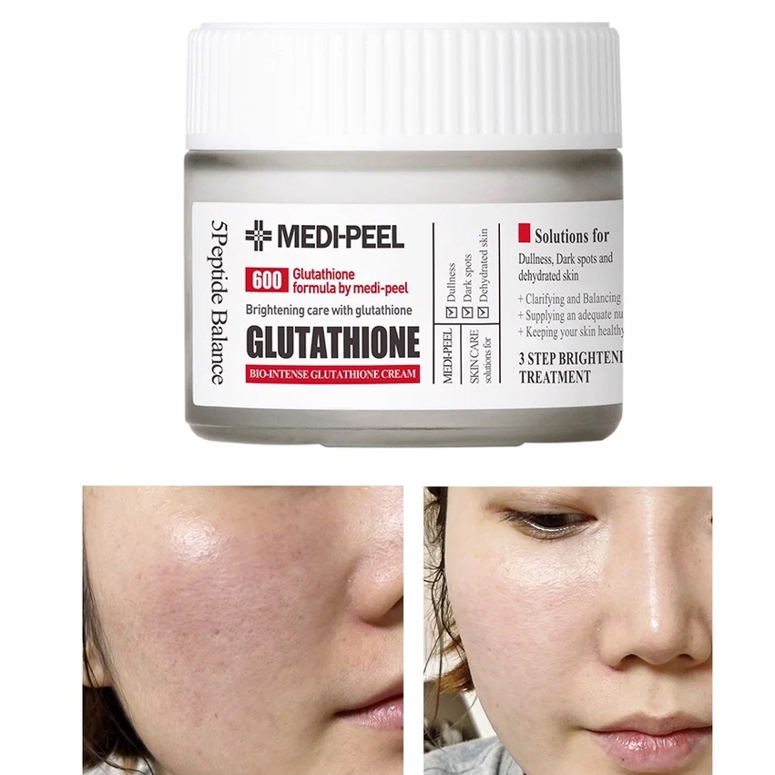 Serum Medi Peel Kem Dưỡng Trắng Da Medi-Peel Glutathione 600 Hàn Quốc