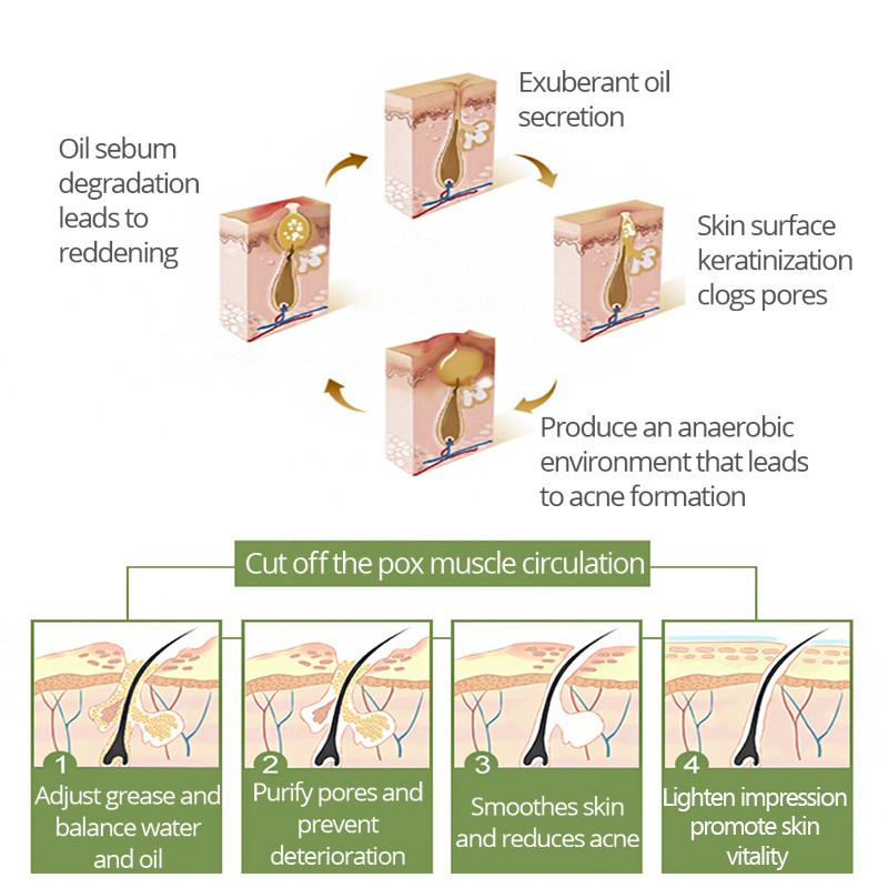 Toner VIBRANT GLAMOUR Chiết Xuất Tràm Trà Hỗ Trợ Giảm Mụn Và Sẹo Cho Da Mặt 30ml