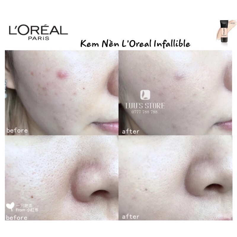 Kem Nền L’Oreal Infallible Pro Matte Tone 101