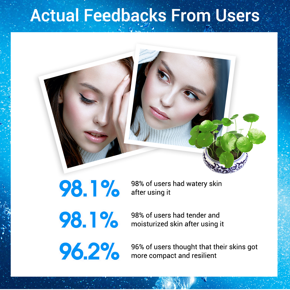 Kem Dưỡng Ẩm Cho Da Mặt Lanbena Với Thành Phần Axit Hyaluronic Hỗ Trợ Ngăn Da Lão Hóa Và Che Nếp Nhăn 50ml | BigBuy360 - bigbuy360.vn