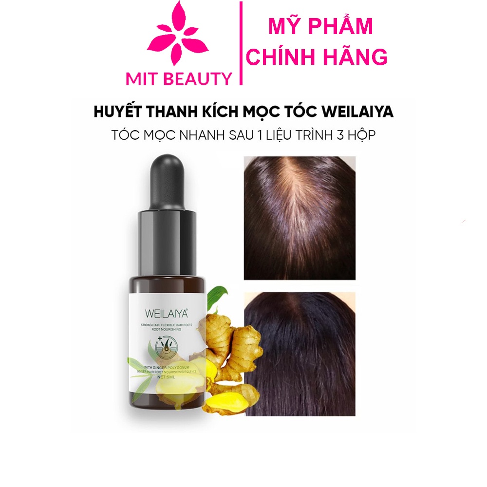 Serum mọc tóc Weilaiya lọ 5ml Mit Beauty hỗ trợ kích mọc tóc hạn chế rụng nuôi dưỡng da đầu