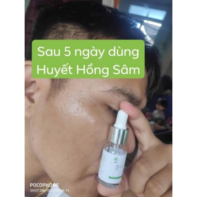 Huyết Hồng Sâm - Vua Diệt Mụn - Serum 10ml - Đông Y Vũ Đức | BigBuy360 - bigbuy360.vn