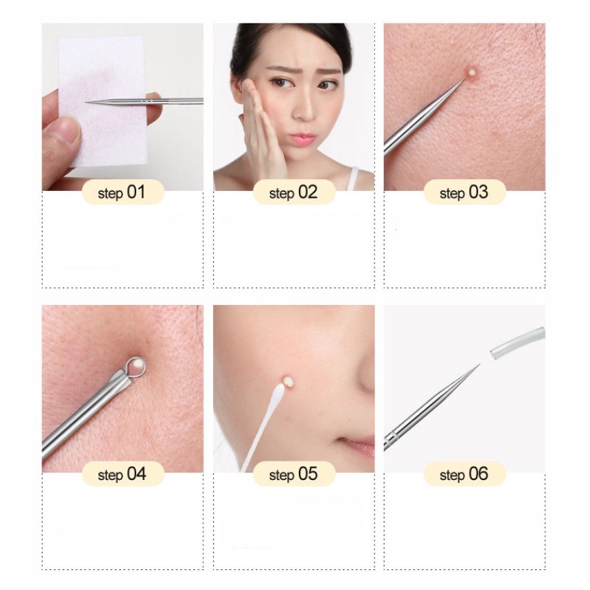 Bộ Dụng Cụ Loại Bỏ Mụn Đầu Đen Bằng Thép Không Gỉ