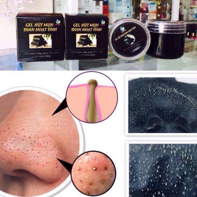 GEL HÚT MỤN THAN HOẠT TÍNH